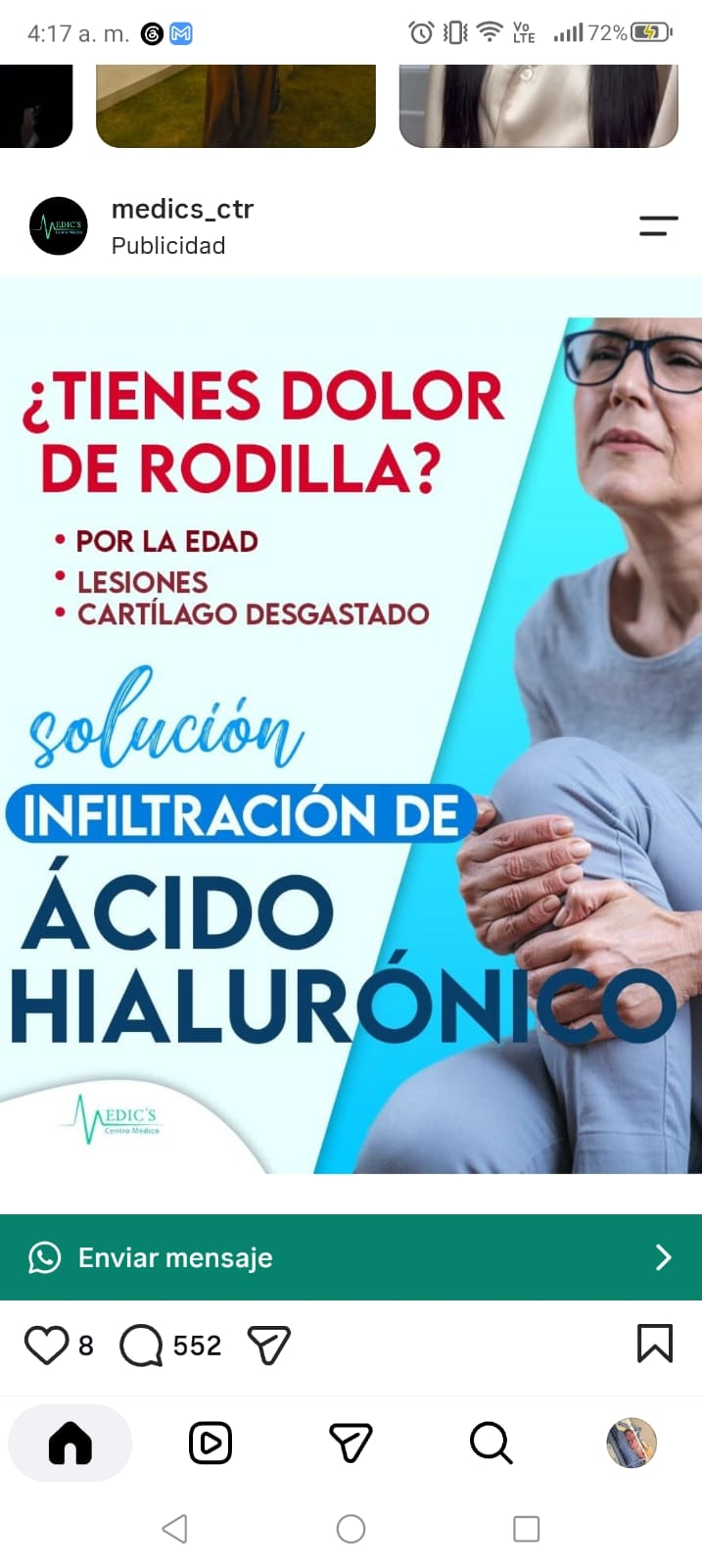 Imagen proporcionada sobre dolor de rodilla e infiltraciones de ácido hialurónico